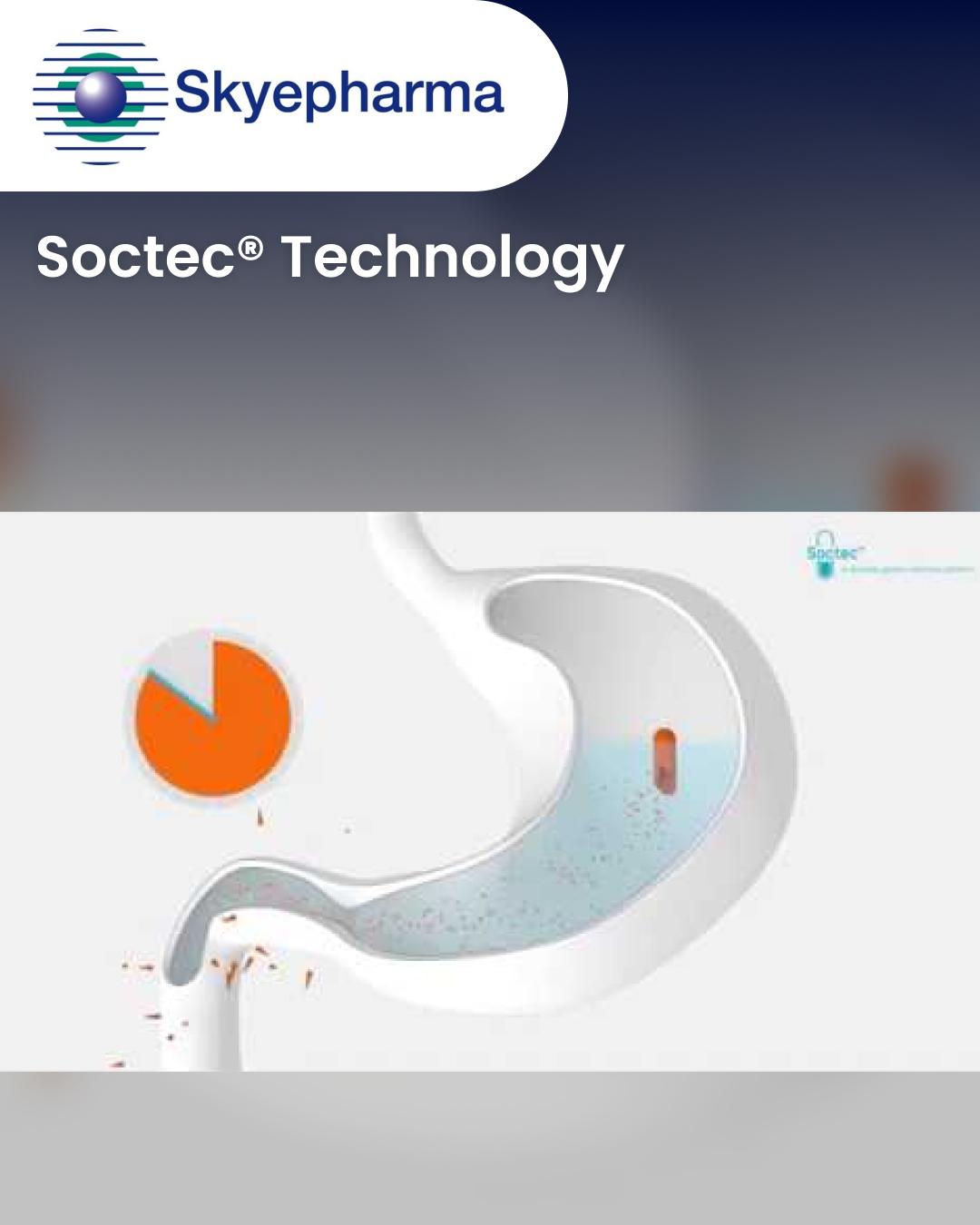 Soctec® Technology